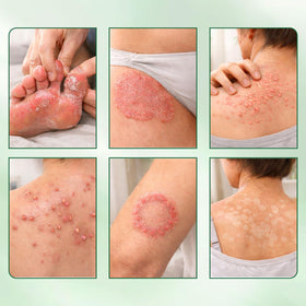 WNOHIQ Intertrigo Relief Cream ingredients list