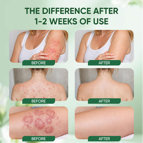 WNOHIQ Intertrigo Relief Cream texture close-up