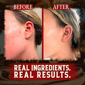 Wrath & Remedy Organic Beef Tallow Balm in lifestyle setting
