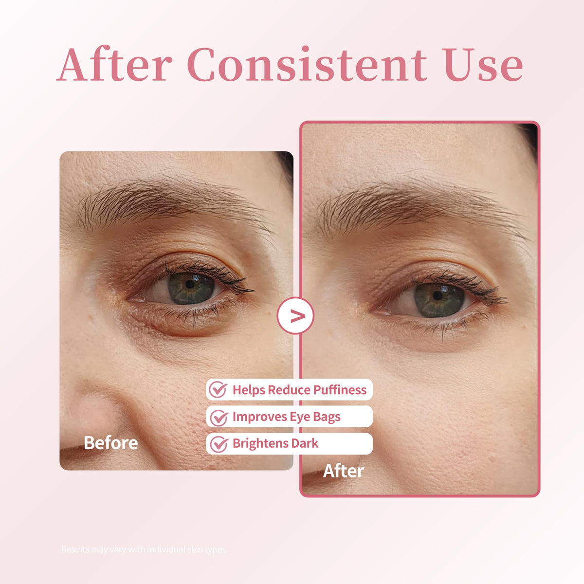 Xenjura eye serum showing texture on skin