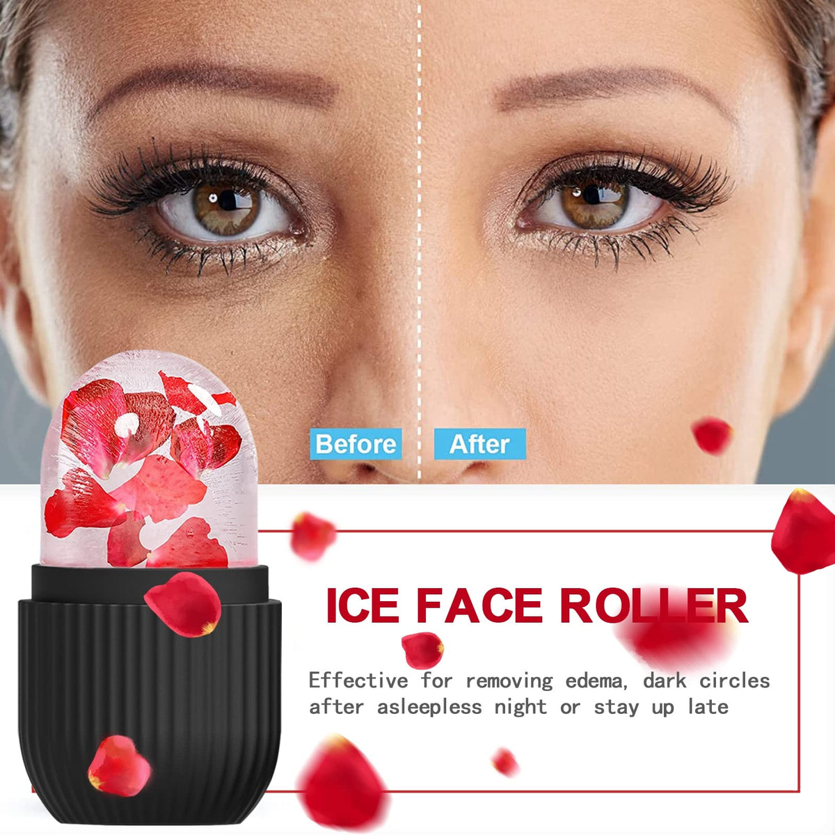 XHJRI Ice Face Roller showing ice mould