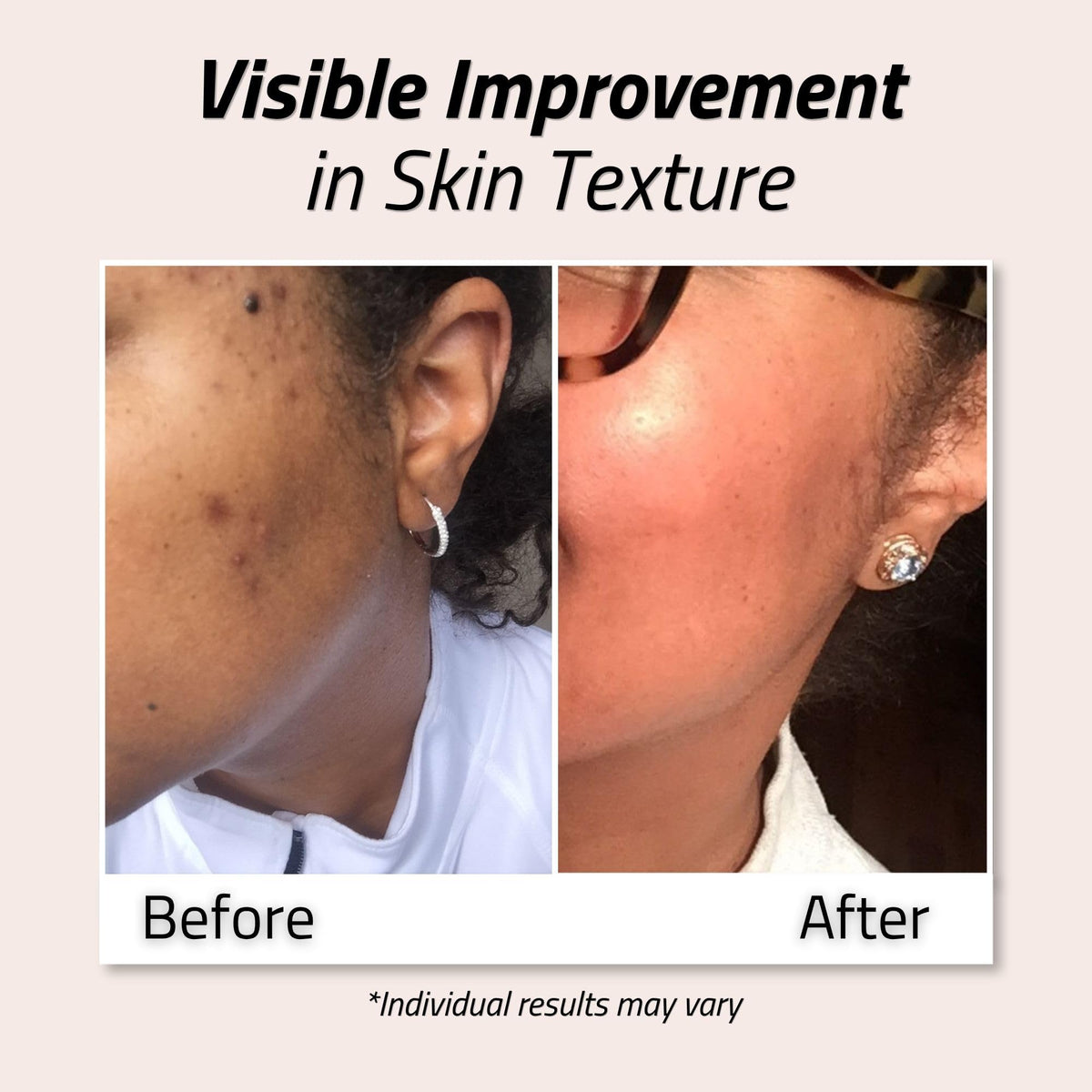YEOUTH Glycolic Acid Toner 8% application on cotton pad