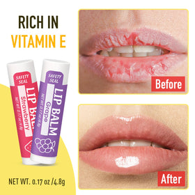 YesBes Lip Balm set perfect for gifting
