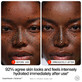 Youth To The People Superberry Dream Mask applied on skin