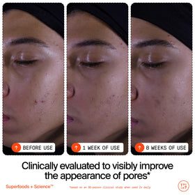 Youth To The People Superfruit Exfoliating Cleanser with ginger root