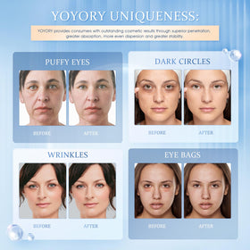 YOYORY Under Eye Patches gel pads close-up