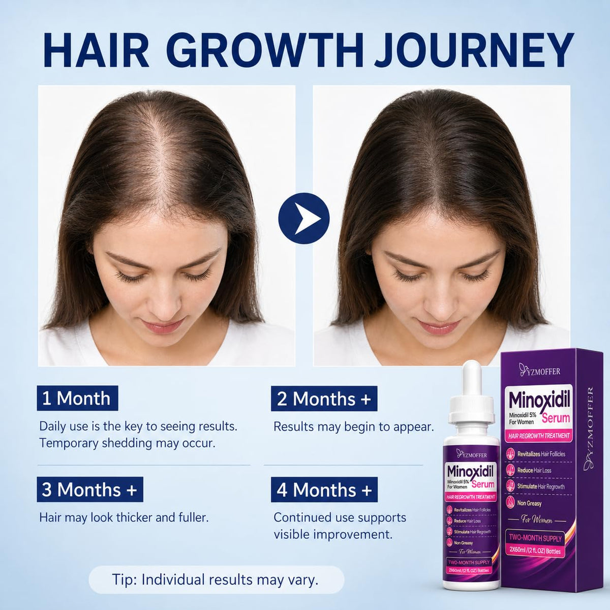 Yzmoffer Minoxidil 5% Hair Regrowth packaging