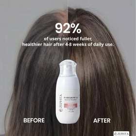 Zephta H-Regrow Hair Growth Spray bottle back view