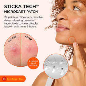 ZitSticka Killa Kit Microdart Pimple Patch with CLEANA swabs