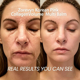 zorevyn Korean Pink Collagenvolume Multi Balm side view